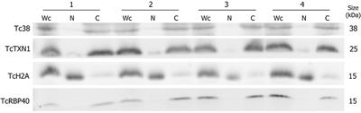 Nuclear Compartmentalization Contributes to Stage-Specific Gene Expression Control in Trypanosoma cruzi